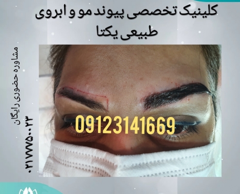 a6a29285-d5a3-46c2-b17b-c2e0801dd094 کاشت ابروی طبیعی 5