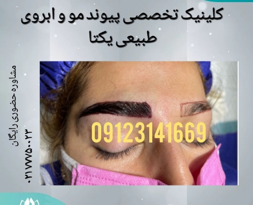 afd0db1b-2440-4dea-8e76-59e88f902fbd کاشت ابروی طبیعی 8