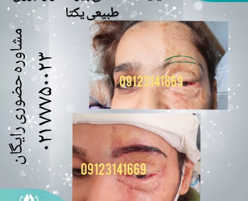 d433884e-e453-4f19-8ce1-3e88dd074217 کاشت ابروی طبیعی 10