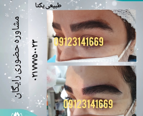 e1bb4507-d33a-4320-a5b6-103d5bc88f1a کاشت ابروی طبیعی 13