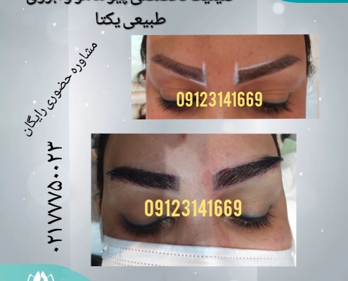 e5415771-6990-4b3e-bb1f-3ac427bb0f3d کاشت ابروی طبیعی 15