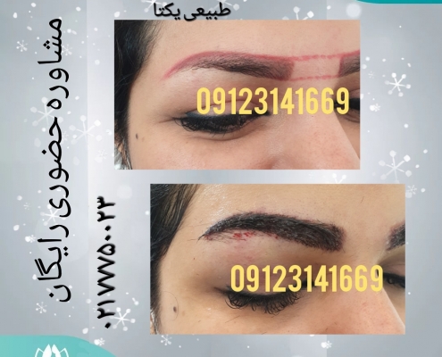 e5d141a3-7b82-409a-974c-58df8228ca61 کاشت ابروی طبیعی 14