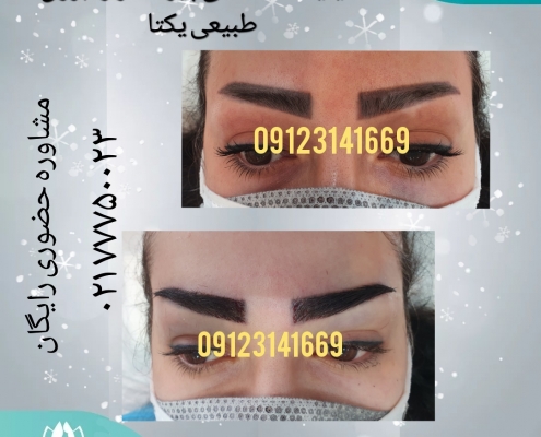 f2b3a7ab-8919-4c50-b38c-bcbc139b0629 کاشت ابروی طبیعی 16